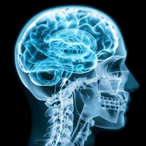 Traumatic Brain Injury – What It Is, Why It Happens