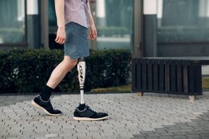 New Medical Advances in Prosthetic Technology